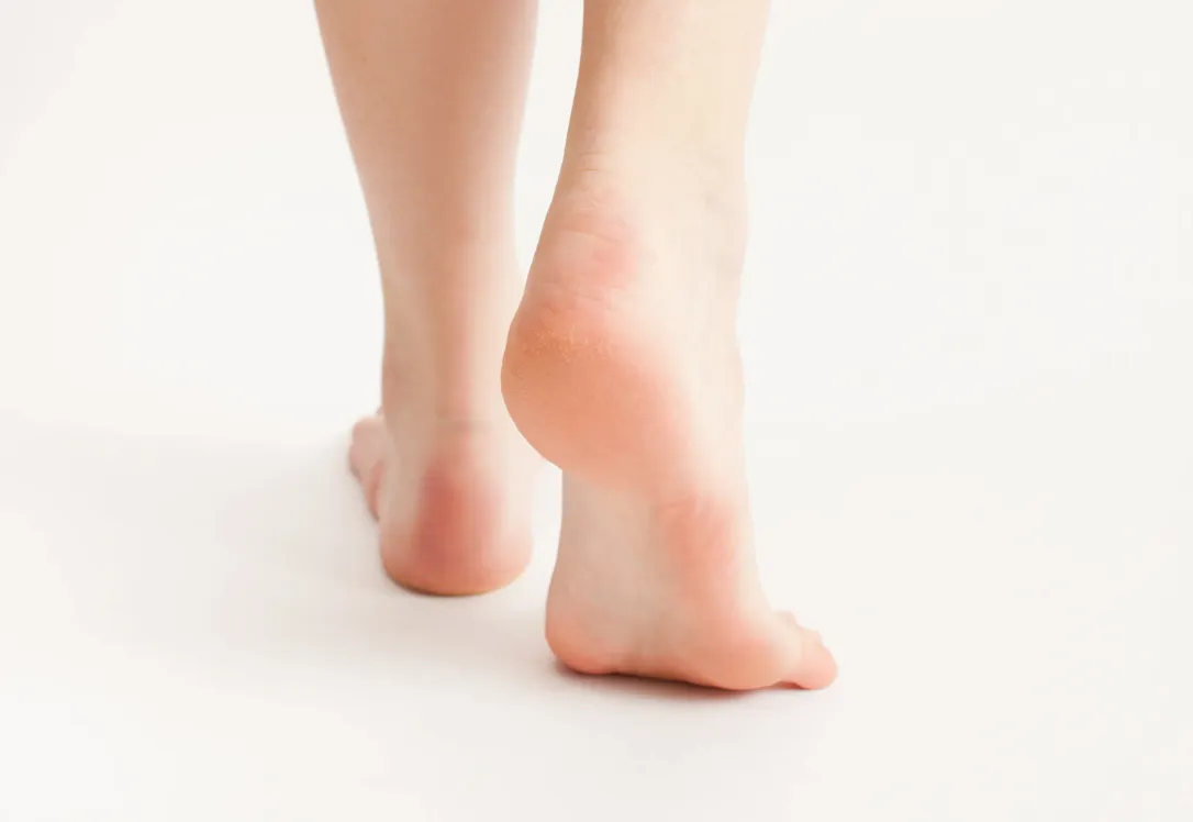Hand and Heel Butter