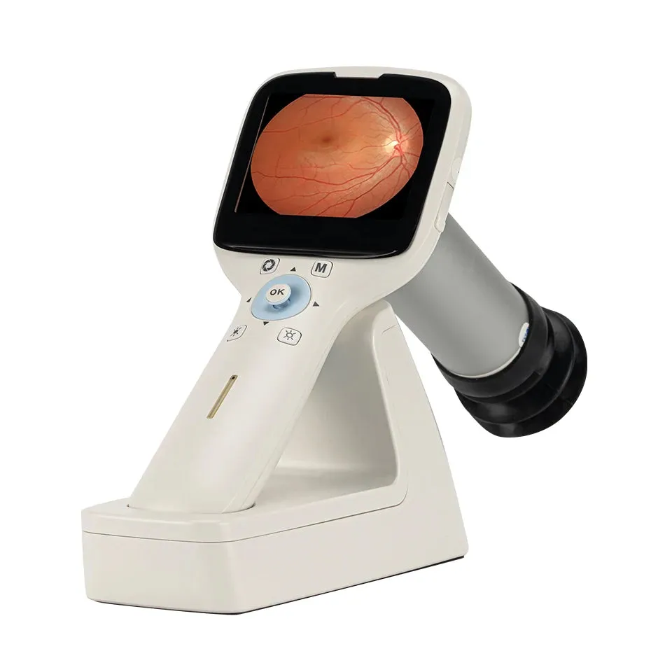 High Definition Handheld Eye Fundus Camera (MHFC1): Digital Portable Ophthalmic Instrument for Optics Equipment with HD Imaging