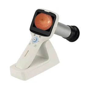 High Definition Handheld Eye Fundus Camera (MHFC1): Digital Portable Ophthalmic Instrument for Optics Equipment with HD Imaging