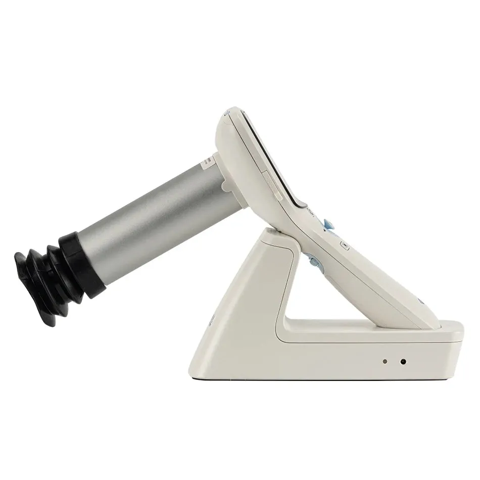 High Definition Handheld Eye Fundus Camera (MHFC1): Digital Portable Ophthalmic Instrument for Optics Equipment with HD Imaging