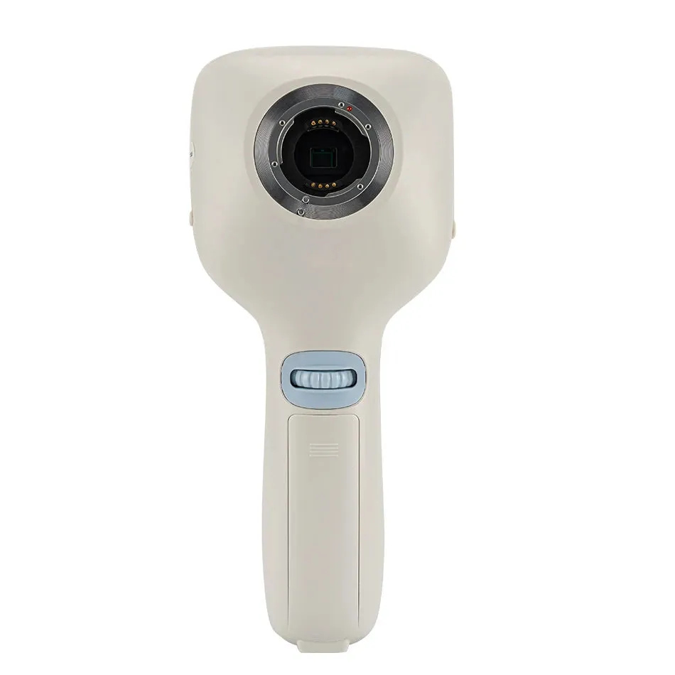 High Definition Handheld Eye Fundus Camera (MHFC1): Digital Portable Ophthalmic Instrument for Optics Equipment with HD Imaging