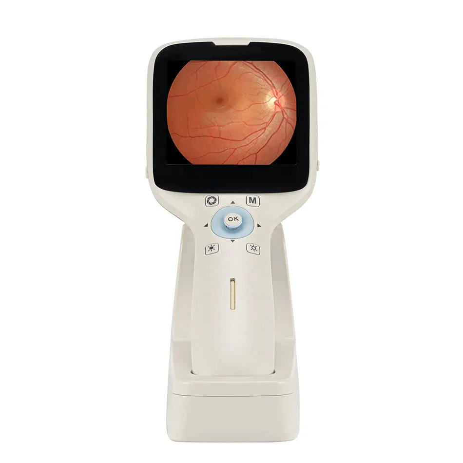 High Definition Handheld Eye Fundus Camera (MHFC1): Digital Portable Ophthalmic Instrument for Optics Equipment with HD Imaging