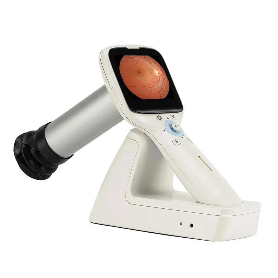 High Definition Handheld Eye Fundus Camera (MHFC1): Digital Portable Ophthalmic Instrument for Optics Equipment with HD Imaging