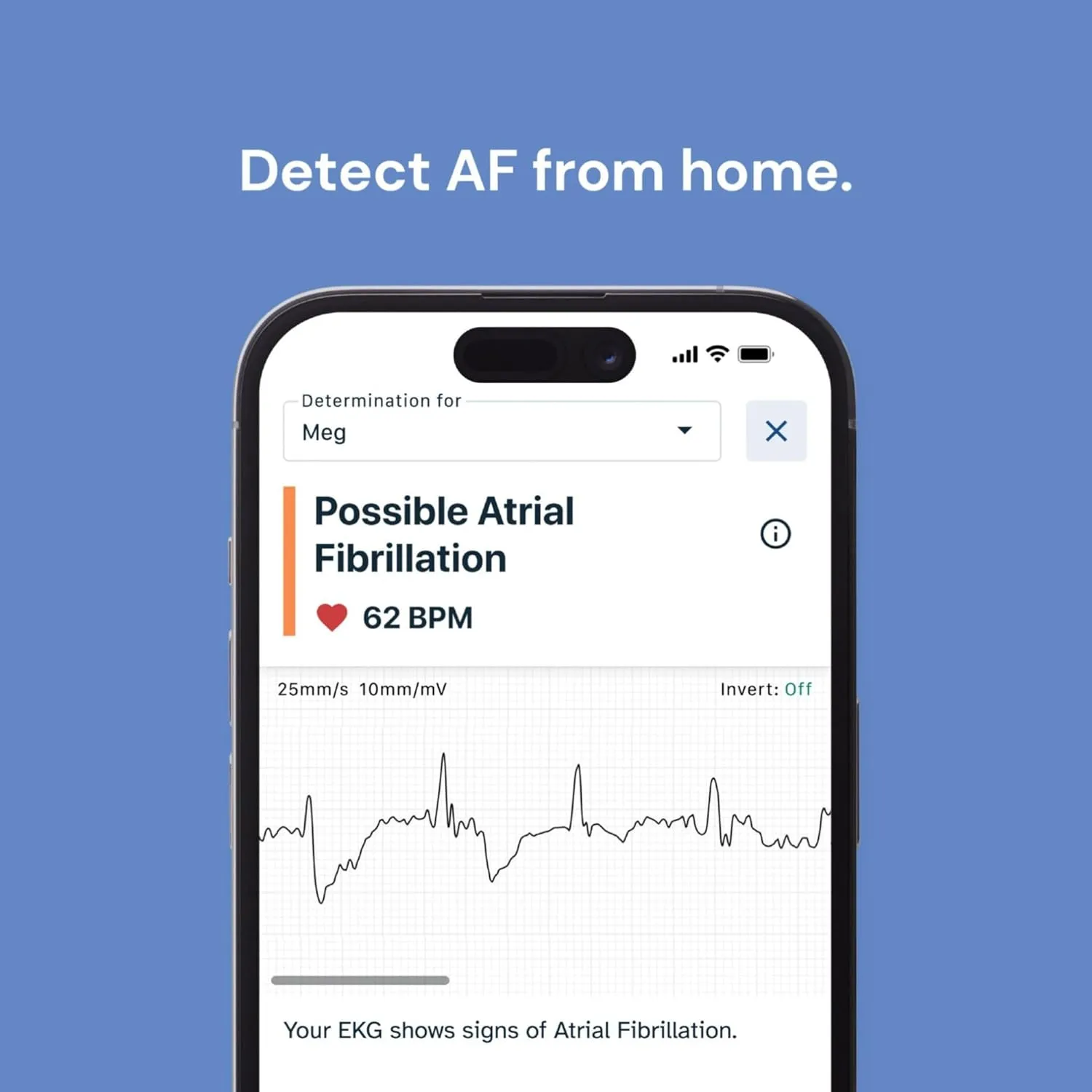 KardiaMobile 1-Lead Personal ECG Heart Monitor Convenient, Accurate Heart Health Monitoring