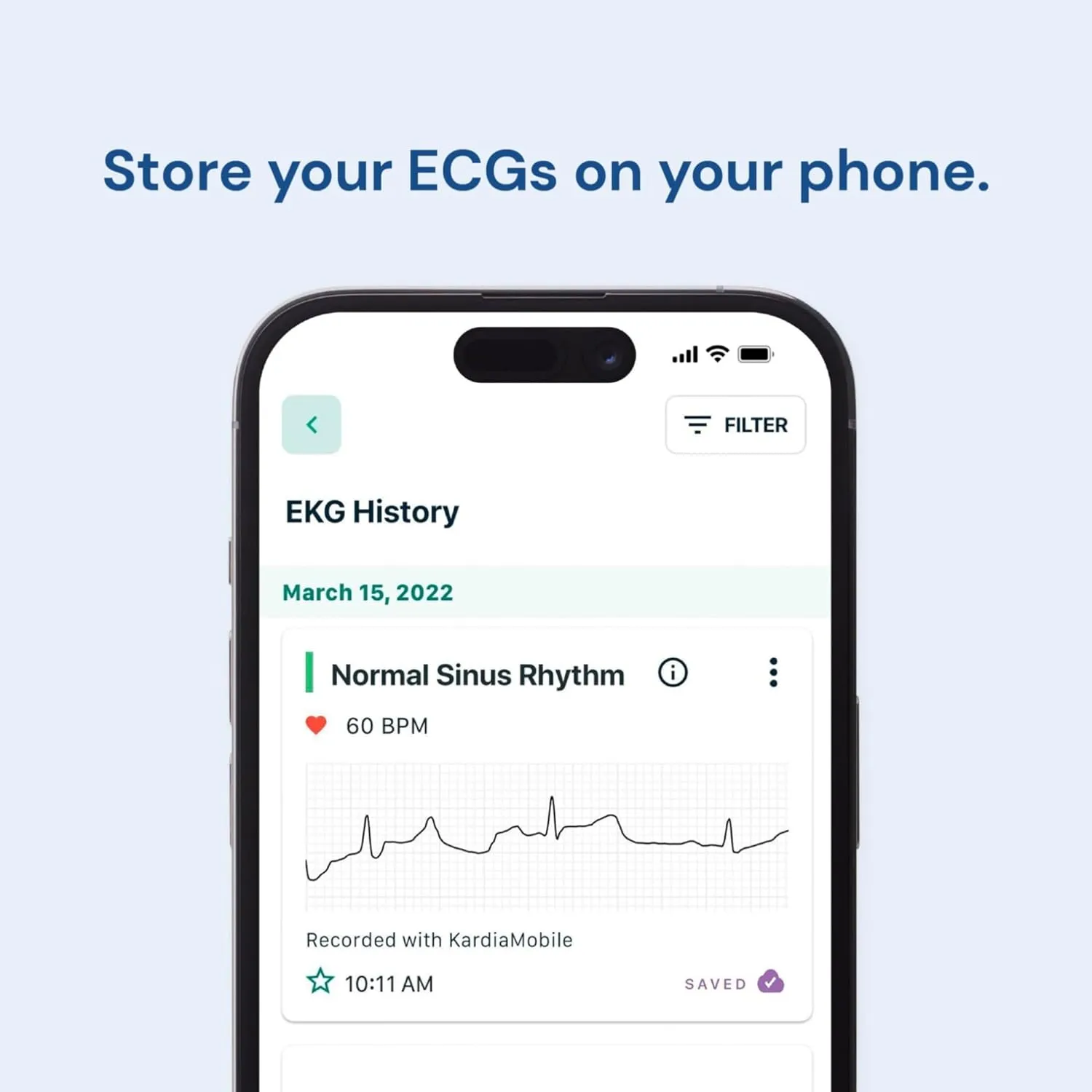 KardiaMobile 1-Lead Personal ECG Heart Monitor Convenient, Accurate Heart Health Monitoring
